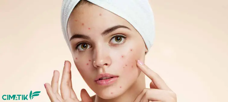 صابون گیاهی برای لک صورت از کجا بخریم؟